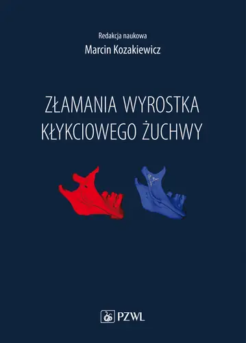 Okładka: Złamania wyrostka kłykciowego żuchwy