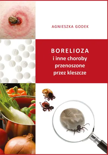 Okładka: Borelioza i inne choroby przenoszone przez kleszcze