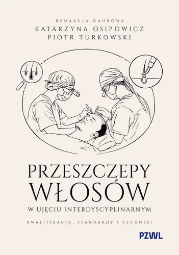 Okładka: Przeszczepy włosów w ujęciu interdyscyplinarnym. Kwalifikacja, standardy i techniki
