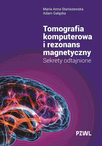 Okładka: Tomografia komputerowa i rezonans magnetyczny