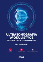 Okładka: Ultrasonografia w okulistyce
