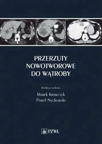 Okładka: Przerzuty nowotworowe do wątroby