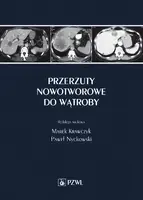 Okładka: Przerzuty nowotworowe do wątroby