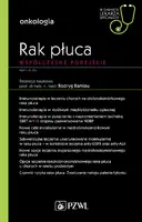 Okładka: Rak płuca. Współczesne podejście