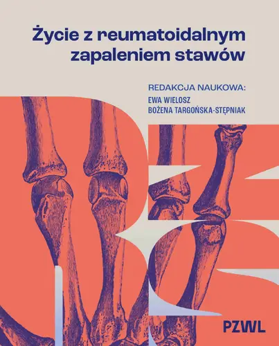 Okładka: Życie z reumatoidalnym zapaleniem stawów