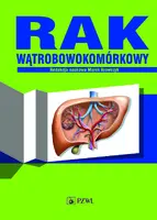 Okładka: Rak wątrobowokomórkowy