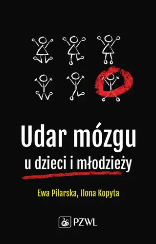 Okładka: Udar mózgu u dzieci i młodzieży
