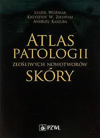 Okładka: Atlas patologii złośliwych nowotworów skóry
