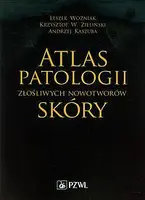 Okładka: Atlas patologii złośliwych nowotworów skóry