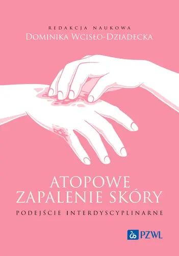 Okładka: Atopowe zapalenie skóry. Podejście interdyscyplinarne