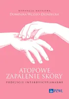 Okładka: Atopowe zapalenie skóry. Podejście interdyscyplinarne