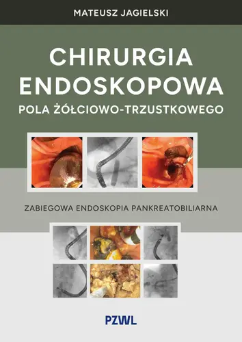 Okładka: Chirurgia endoskopowa pola żółciowo-trzustkowego