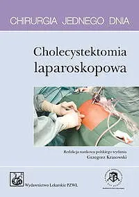 Okładka: Cholecystektomia laparoskopowa