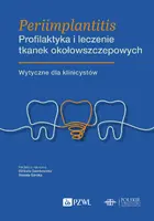 Okładka: Periimplantitis. Profilaktyka i leczenie tkanek okołowszczepowych