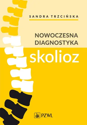 Okładka: Nowoczesna diagnostyka skolioz