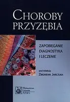 Okładka: Choroby przyzębia