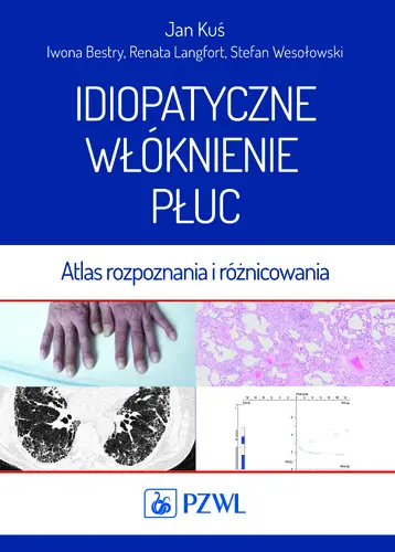 Okładka: Idiopatyczne włóknienie płuc