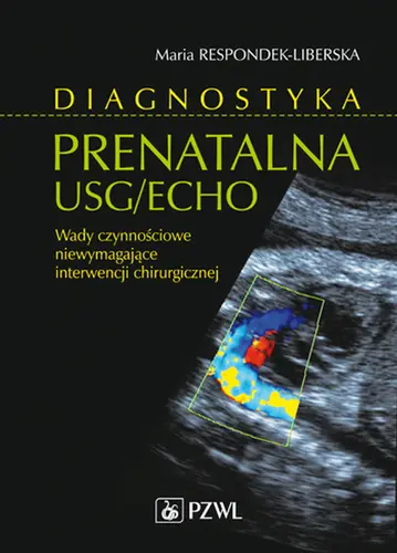 Okładka: Diagnostyka prenatalna USG/ECHO. Wady niewymagające interwencji chirurgicznej