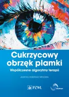 Okładka: Cukrzycowy obrzęk plamki.