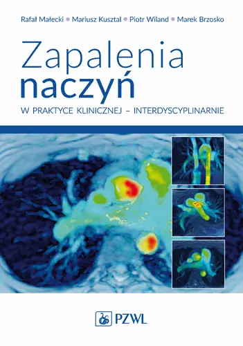 Okładka: Zapalenia naczyń – w praktyce klinicznej interdyscyplinarnie