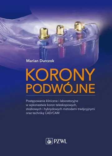 Okładka: Korony podwójne. Postępowanie kliniczne i laboratoryjne w wykonastwie koron teleskopowych, stożkowych i hybrydowych metodami tradycyjnymi oraz techniką CAD/CAM