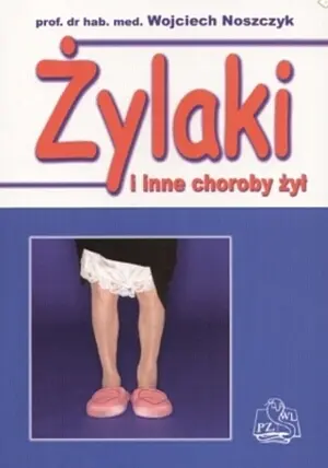 Okładka: Żylaki i inne choroby żył