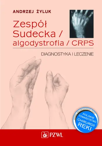 Okładka: Algodystrofia