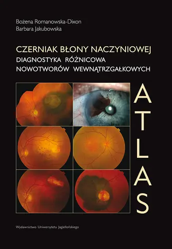 Okładka: Czerniak błony naczyniowej Atlas