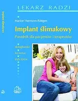 Okładka: Implant ślimakowy