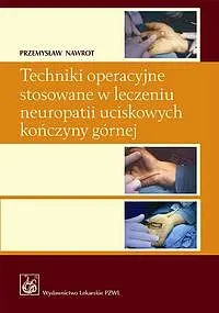 Okładka: Techniki operacyjne stosowane w leczeniu neuropatii uciskowych kończyny górnej