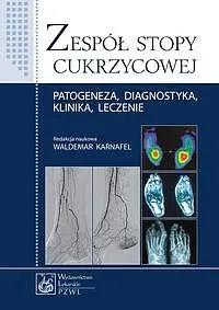 Okładka: Zespół stopy cukrzycowej