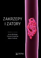 Okładka: Zakrzepy i zatory