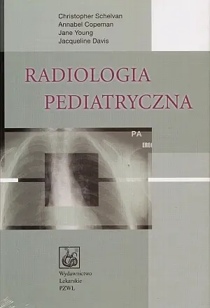 Okładka: Radiologia pediatryczna