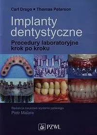 Okładka: Implanty dentystyczne