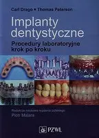 Okładka: Implanty dentystyczne