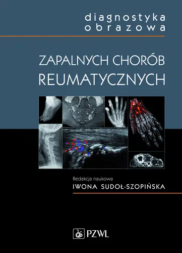 Okładka: Diagnostyka obrazowa zapalnych chorób reumatycznych